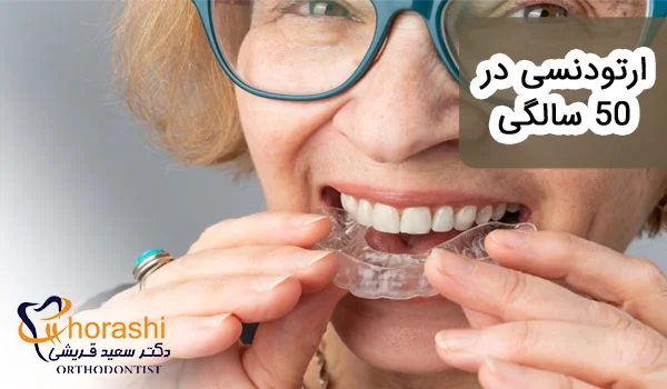 ارتودنسی در 50 سالگی