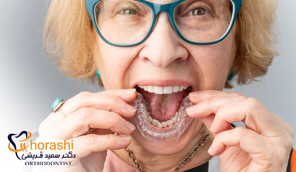 ارتودنسی نامرئی متحرک در سنین بالا