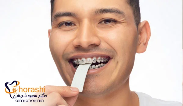 تاثیر آدامس بدون قند بر ارتودنسی