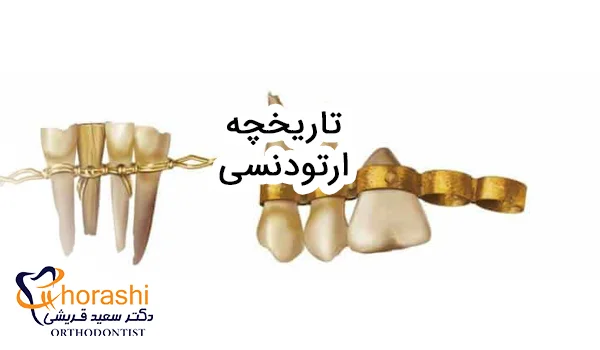 تاریخچه ارتودنسی