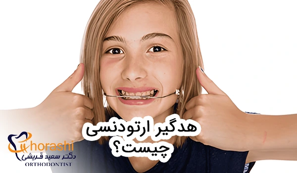 هدگیر ارتودنسی چیست