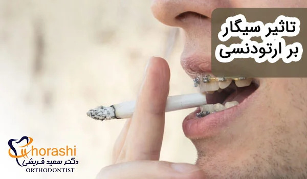 تاثیر سیگار بر ارتودنسی
