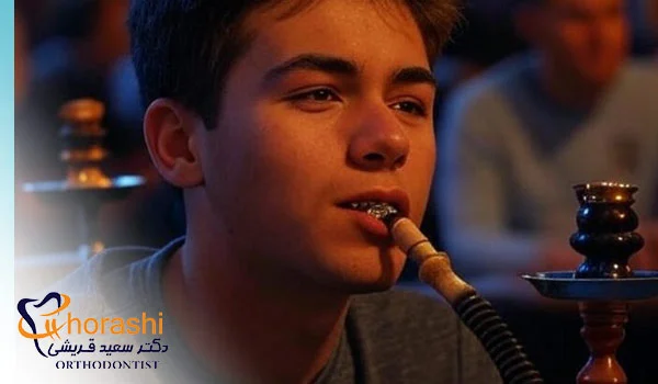 کشیدن قلیان با ارتودنسی