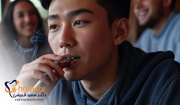 استعمال دخانیات با بریس ارتودنسی