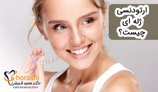 ارتودنسی ژله ای چیست؟