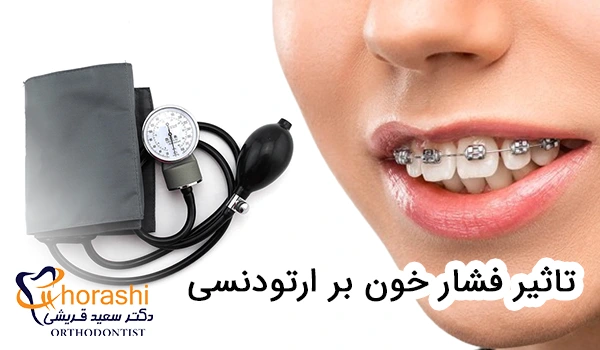 تاثیر فشار خون بر ارتودنسی