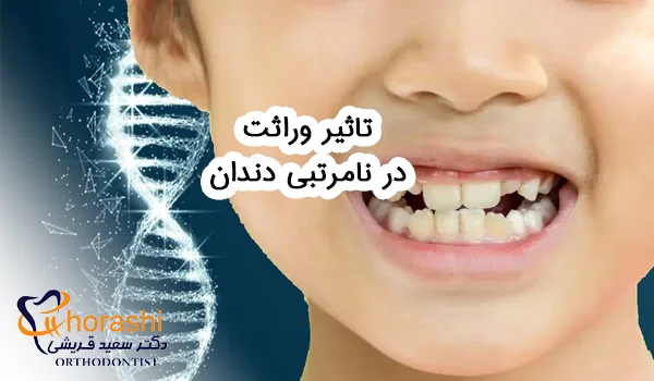 تاثیر وراثت در نامرتبی دندان