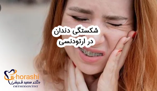 شکستگی دندان در ارتودنسی