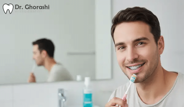 بلیچینگ بعد از ارتودنسی دکتر قریشی