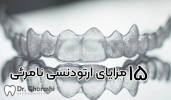 15 تا از مزایای ارتودنسی نامرئی