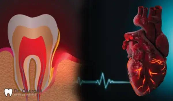 رابطه بین بیماری قلبی و ارتودنسی