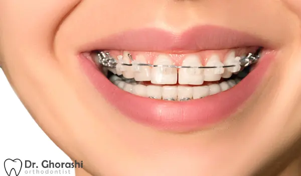 ارتباط وراثت با مشکلات فکی