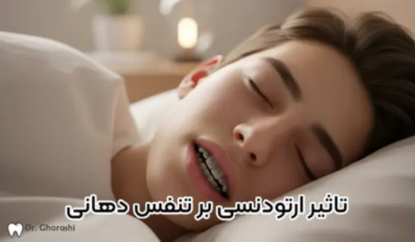 تاثیر ارتودنسی بر تنفس دهانی