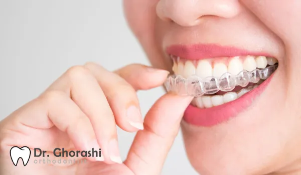 How to shave teeth before invisalign