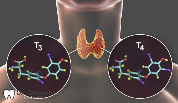 تیروئید چگونه در پروسه ارتودنسی اثر گذار است؟