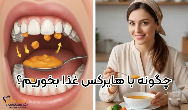 پس از نصب هایکرس چگونه غذا بخوریم؟