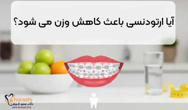 آیا ارتودنسی باعث کاهش وزن می شود؟
