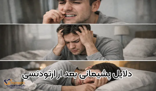 پشیمانی بعد از ارتودنسی