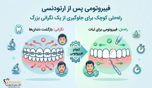 کاربرد فیبروتومی در ارتودنسی چیست؟