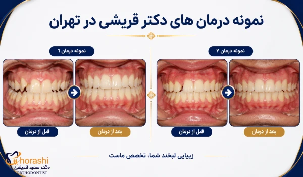 نمونه درمان های دکتر قریشی در تهران