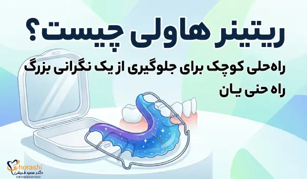 نگه دارنده هاولی چیست؟