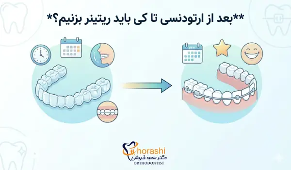 چند روز بعد ارتودنسی باید از نگهدارند استفاده کنیم