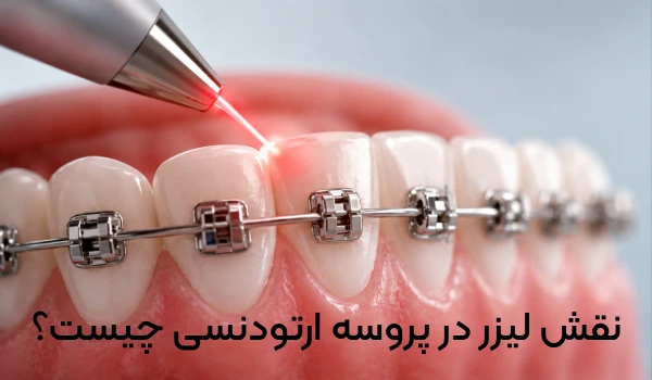 ارتودنسی با لیزر