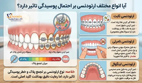 انواع ارتودنسی و پوسیدگی دندان