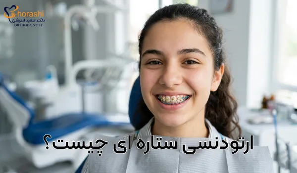 ارتودنسی ستاره‌ای چیست؟