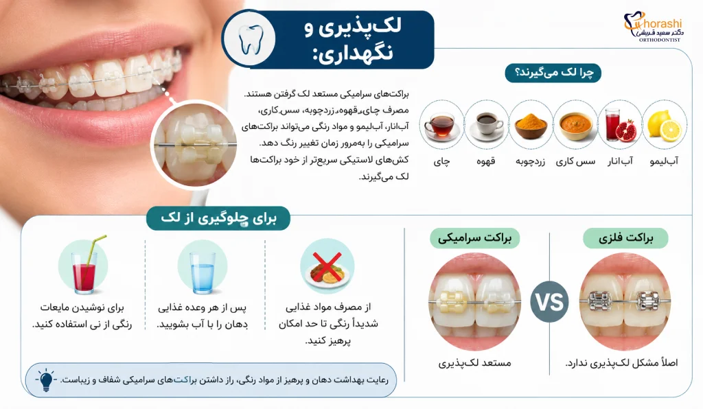 مشکل لکه در ارتودنسی سرامیکی