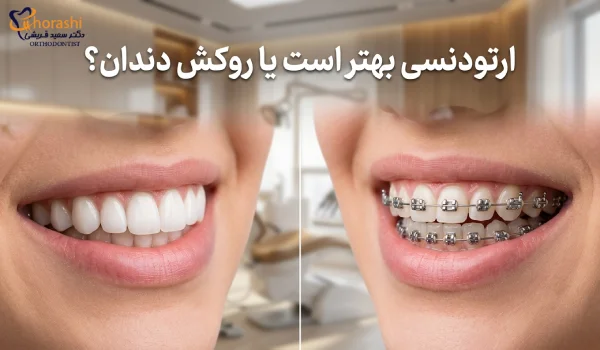 ارتودنسی بهتر است یا روکش کردن دندان؟