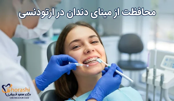 محافظت مینای دندان در ارتودنسی