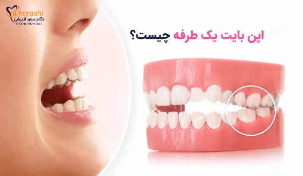 اپن بایت یک طرفه چیست؟