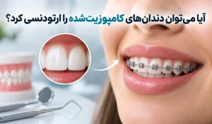 ارتودنسی دندان کامپوزیت شده