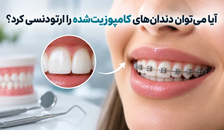 ارتودنسی دندان کامپوزیت شده