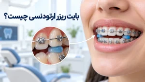 بایت ریزر ارتودنسی چیست