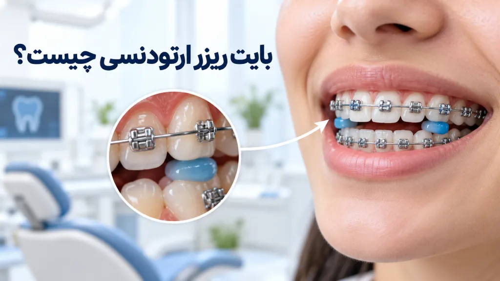 بایت ریزر ارتودنسی چیست