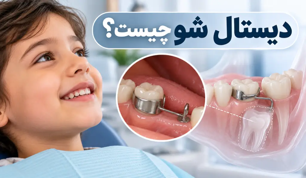 دیستال شو ارتودنسی چیست