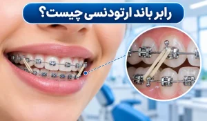 رابر بند ارتودنسی چیست