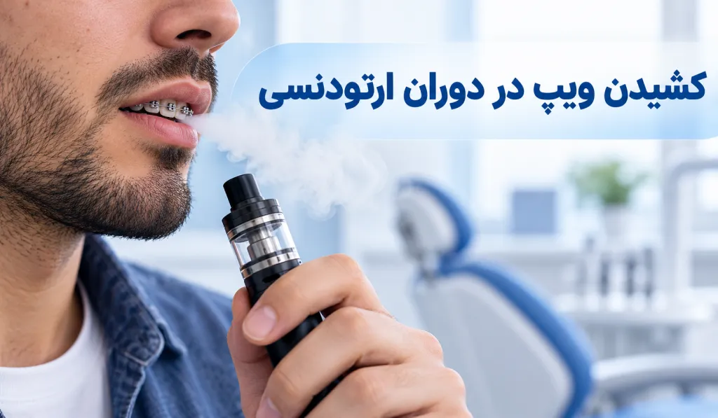 کشیدن ویپ در دوران ارتودنسی ضرر دارد برای دندان ها؟