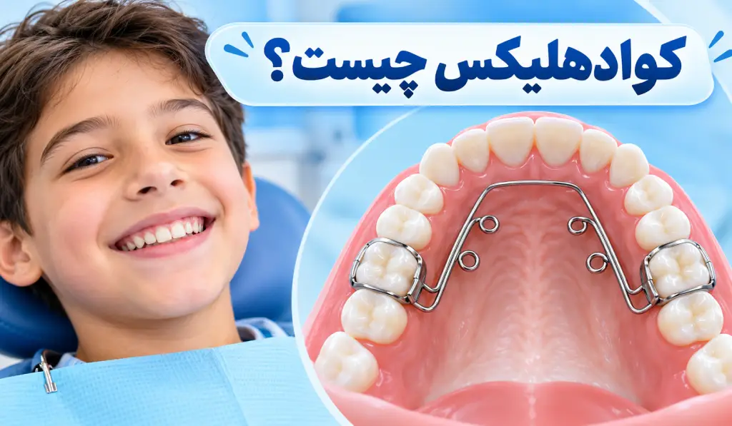 کواد هلیکس ارتودنسی