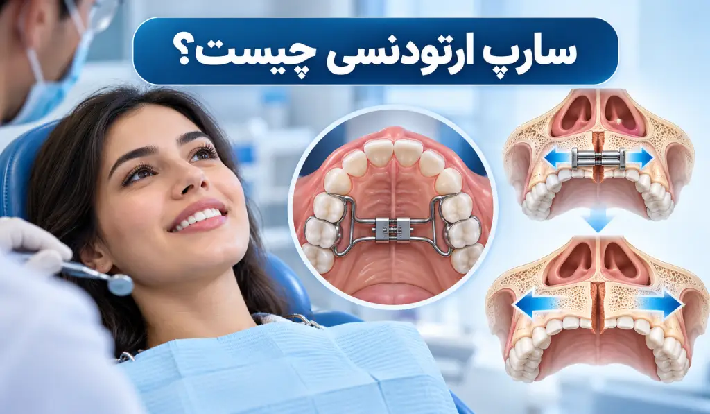سارپ ارتودنسی