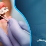 مراحل ارتودنسی دندان