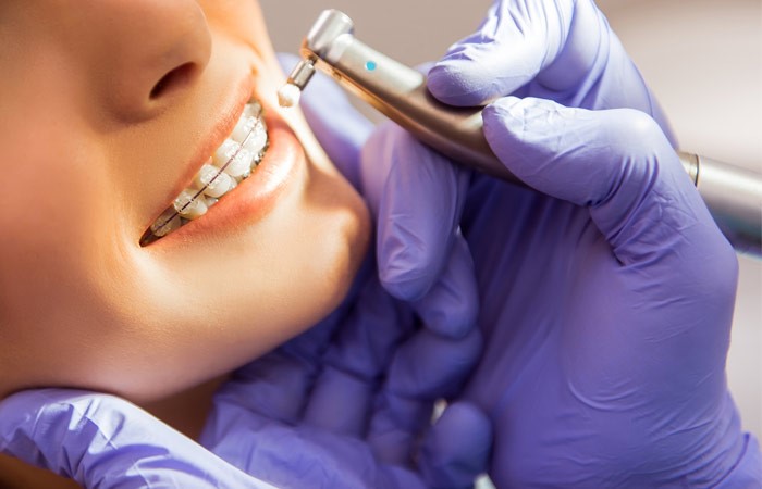 تفاوت ارتودنسی ثابت و متحرک