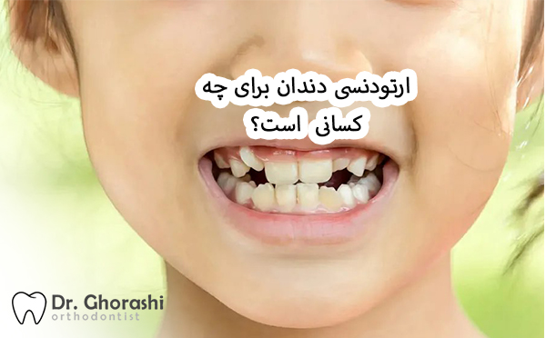 ارتودنسی دندان برای چه کسانی است