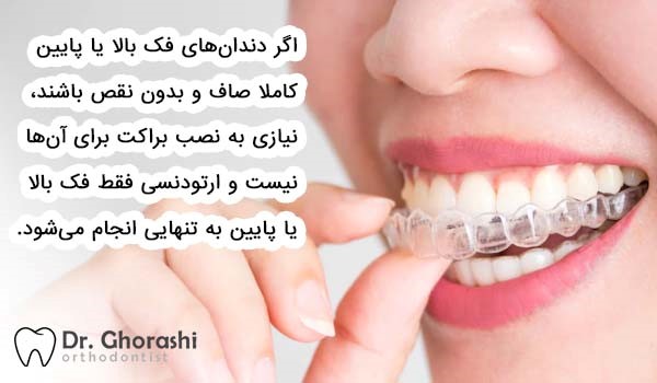 اگر دندان‌های فک بالا یا پایین کاملا صاف و بدون نقص باشند، نیازی به نصب براکت برای آن‌ها نیست و ارتودنسی فقط فک بالا یا پایین به تنهایی انجام می‌شود.