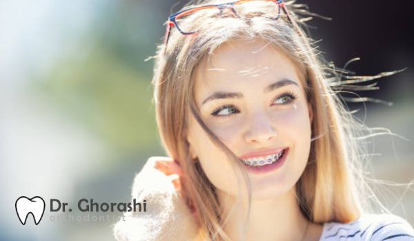 اثر ارتودنسی بر شکل لب‌ها
