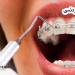 مشاوره ارتودنسی