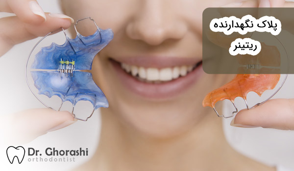ارتودنسی متحرک با ریتینر