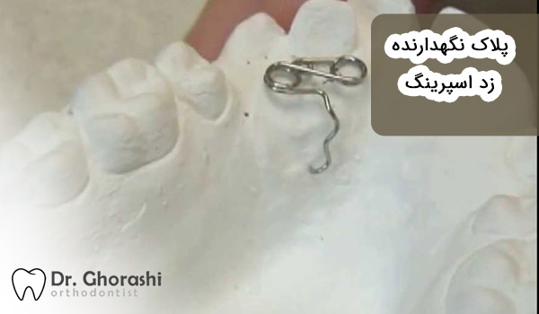 ارتودنسی متحرک با زد اسپرینگ